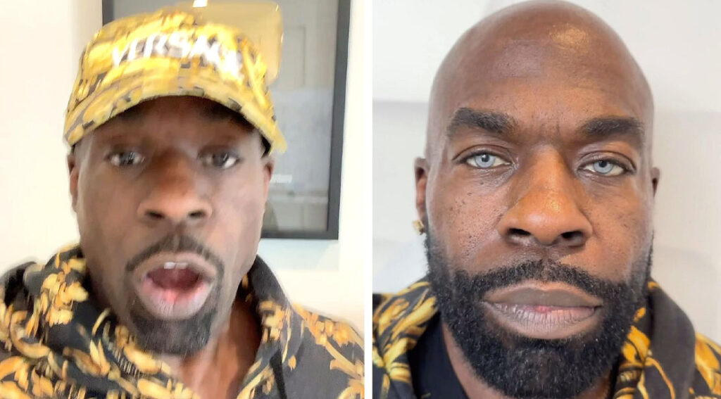 Kali Muscle Undergoes Controversial Eye Color Change Operation