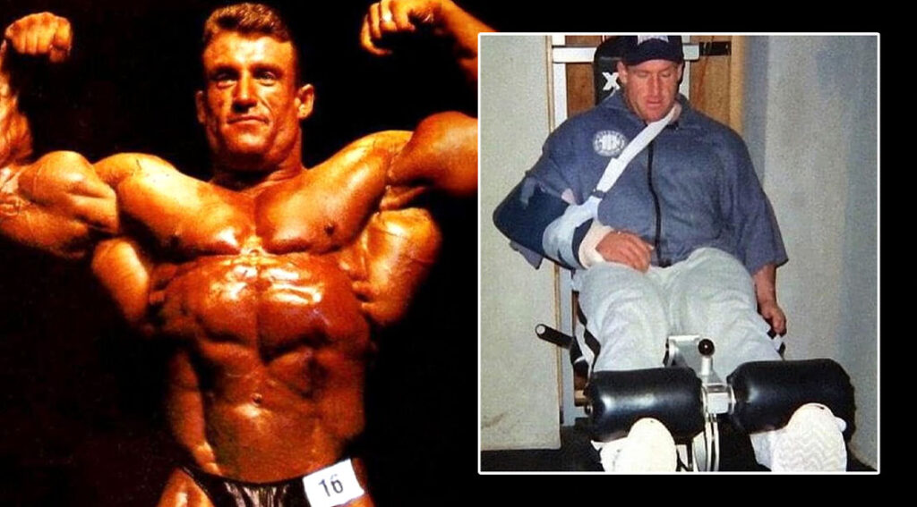 Dorian Yates Used The Crossover Effect To Overcome Injuries
