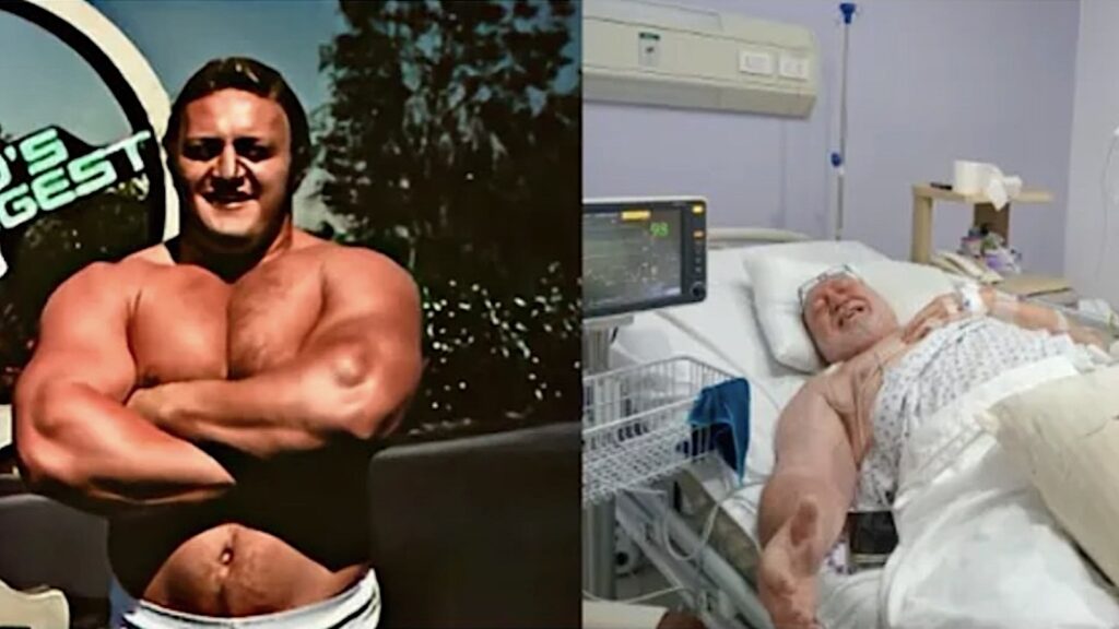 Strongman Legend Bill Kazmaier Speaks About His Health