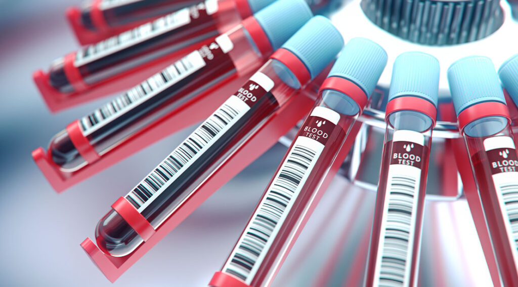 What is EBO2: Blood Detoxing Therapy Boasts to Boost Health